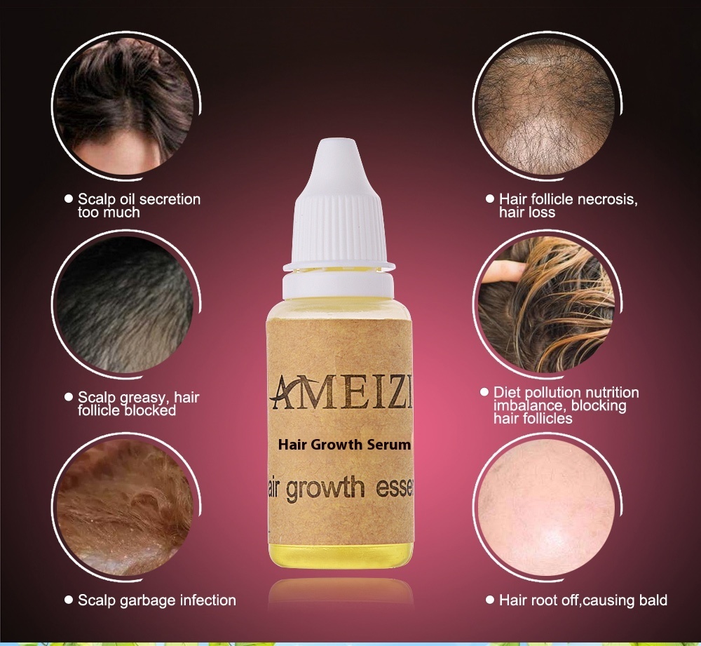 AmeizII Hair Growth Essence مستخلص أميز لنمو الشعر - Image 3