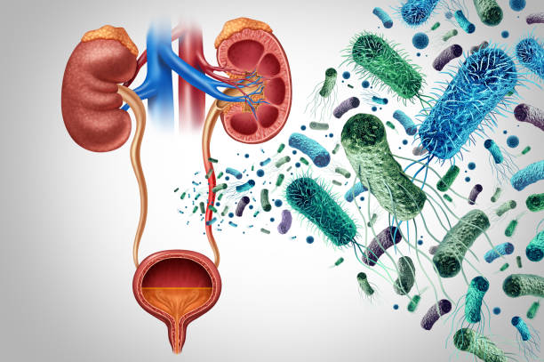 التهاب الكلى